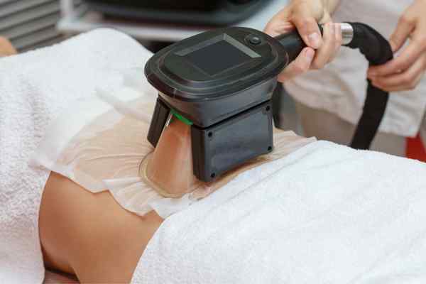 Areas of the Body we treat Cryolipolysis Scottish