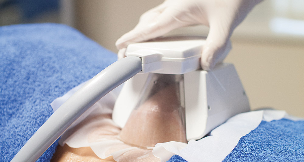 How Fat Freezing and HIFU Work Together? 2 Multiple Areas in One Session HIFU and Fat Freezing Scottish