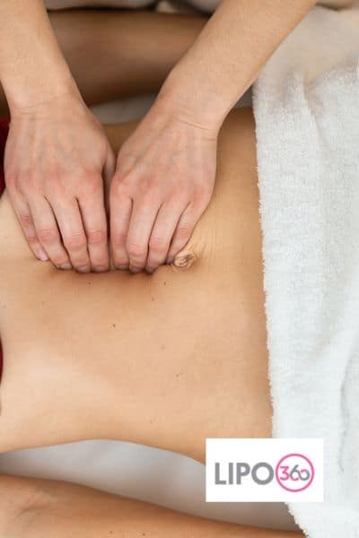 diastasis recti treatment Scottish