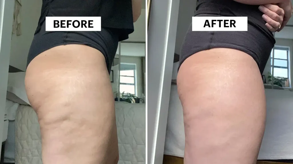 Sculpting Your Bum: Can Toning Exercises Really Reduce Cellulite? 1 Do Toning Exercise Scottish Really Tackle Cellulite?
