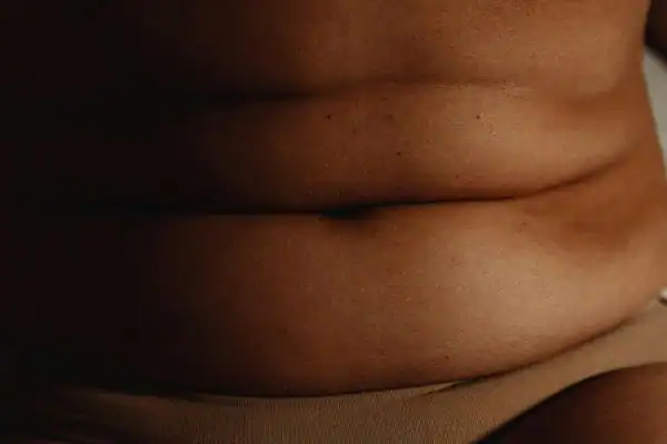 The Hidden Connection: How Stress Shapes Your Fitness and Body Composition 3 image of what stress can do on the stomach area and how Lipo 360 Scottish can help to change your body shape.
